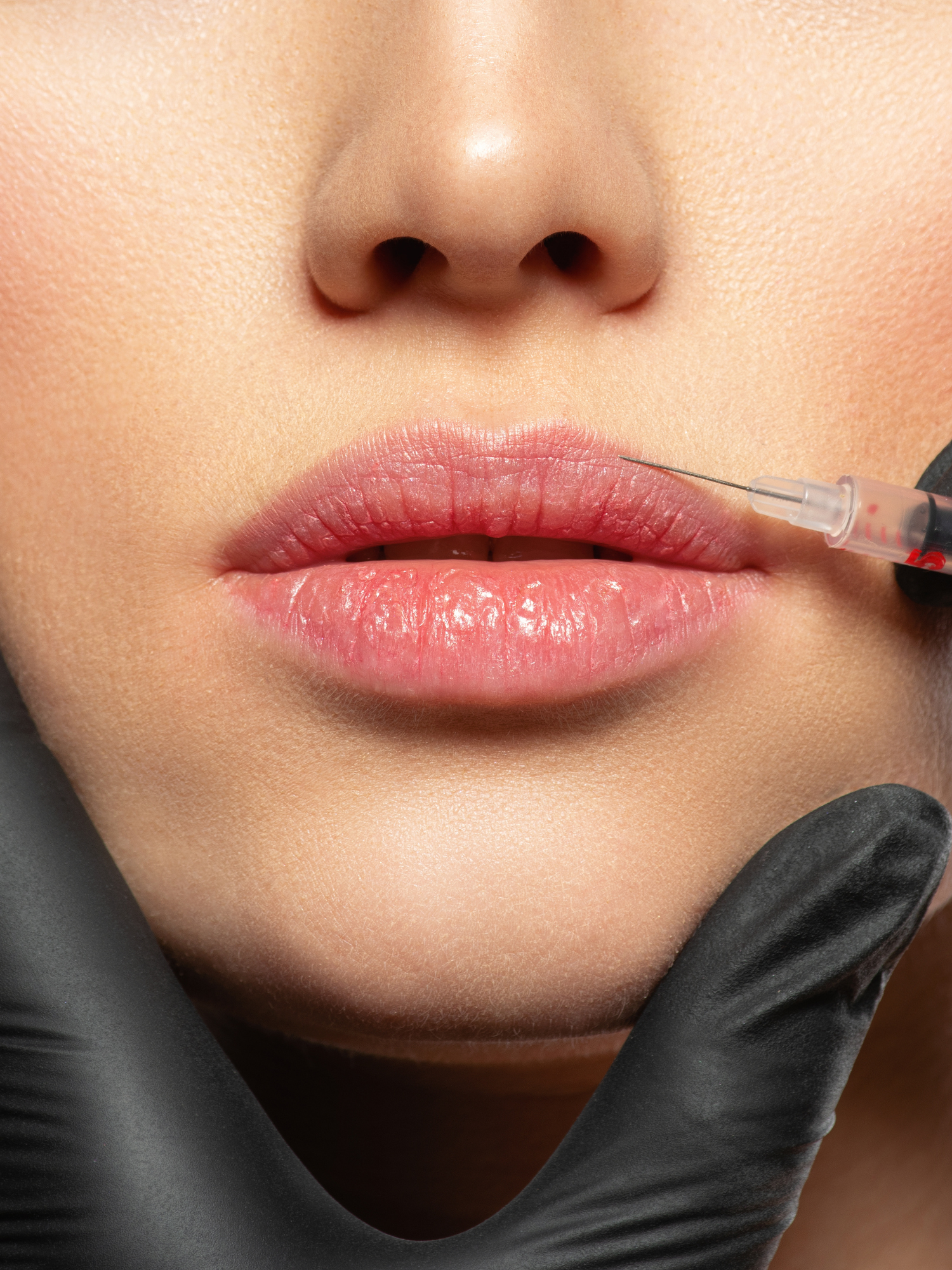 Close-up of lip injection with gloved hands showing precision injectable technique — representing the future of aesthetic medicine and injectables in 2025.